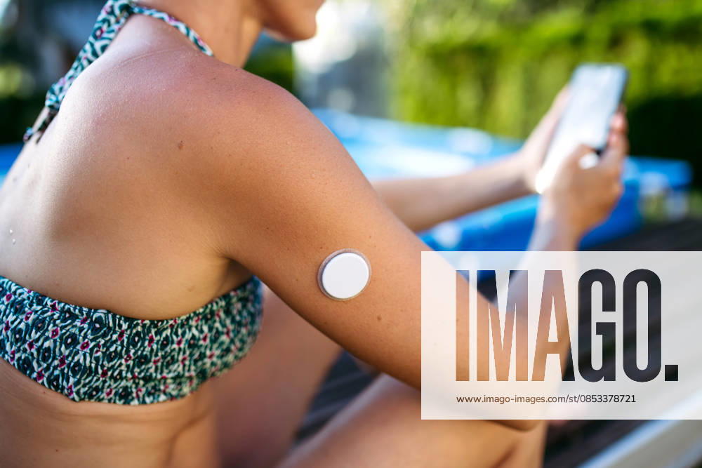 Diabetic woman with CGM on arm checking her blood sugar, sitting by pool. Diabetic woman with CGM on arm checking her glucose level on phone, sitting by pool. model released