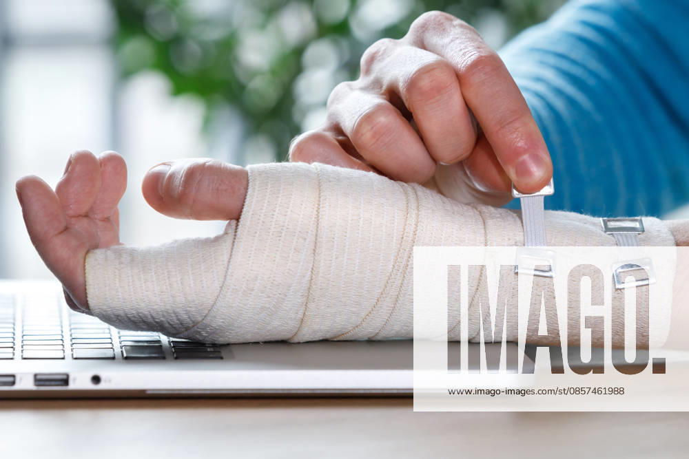 Ein Mann, der sein schmerzendes Handgelenk mit einer orthopädischen Bandage umwickelt Close up of man arms wrapping his painful wrist with Flexible elastic supportive orthopedic bandage caused by prolonged work on laptop. Carpal tunnel syndrome, arthritis, arm sprain concept. (License=RF) ,model released, Symbolfoto