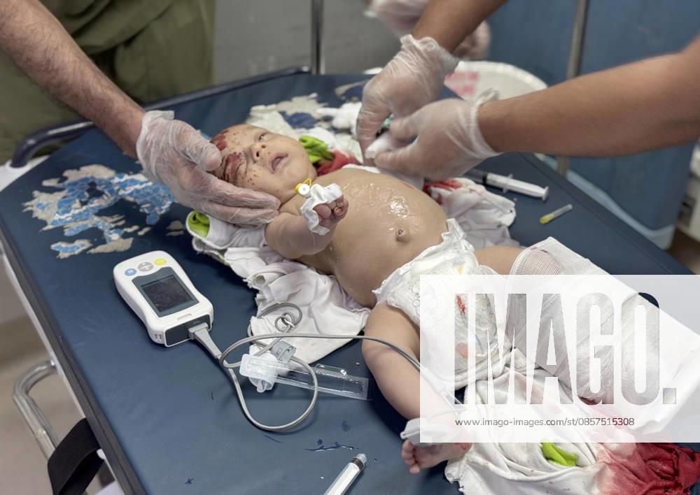Israeli attacks on Gaza continue despite ceasefire agreement KHAN YUNIS, GAZAI PALESTINE - MAY 25: (EDITOR S NOTE: Image depicts graphic content) A Palestinian baby is taken to Nasser Hospital for medical treatment following the Israeli attack on tents housing displaced people in the al-Mawasi area despite the ceasefire agreement in Khan Yunis, Gaza, Palestine on May 25, 2026. A six-year-old child and a woman were killed and 20 people, most of them children and women, were injured in an attack. Abdallah F.s. Alattar Anadolu Khan Yunis Gaza. Editorial use only. Please get in touch for any other usage.