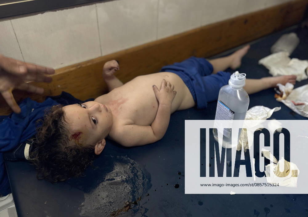 Israeli attacks on Gaza continue despite ceasefire agreement KHAN YUNIS, GAZAI PALESTINE - MAY 25: Palestinian children are taken to Nasser Hospital for medical treatment following the Israeli attack on tents housing displaced people in the al-Mawasi area despite the ceasefire agreement in Khan Yunis, Gaza, Palestine on May 25, 2026. A six-year-old child and a woman were killed and 20 people, most of them children and women, were injured in an attack. Abdallah F.s. Alattar Anadolu Khan Yunis Gaza. Editorial use only. Please get in touch for any other usage.