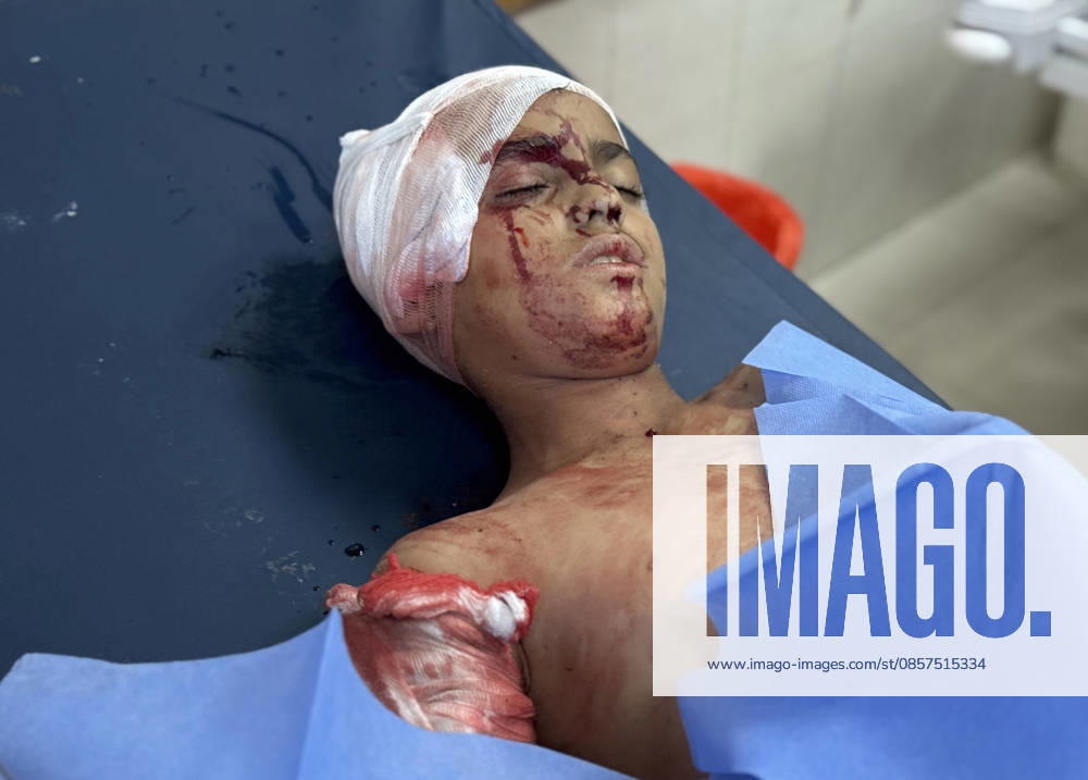 Israeli attacks on Gaza continue despite ceasefire agreement KHAN YUNIS, GAZAI PALESTINE - MAY 25: (EDITOR S NOTE: Image depicts graphic content) Palestinian children are taken to Nasser Hospital for medical treatment following the Israeli attack on tents housing displaced people in the al-Mawasi area despite the ceasefire agreement in Khan Yunis, Gaza, Palestine on May 25, 2026. A six-year-old child and a woman were killed and 20 people, most of them children and women, were injured in an attack. Abdallah F.s. Alattar Anadolu Khan Yunis Gaza. Editorial use only. Please get in touch for any other usage.