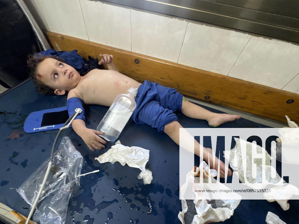 Israeli attacks on Gaza continue despite ceasefire agreement KHAN YUNIS, GAZAI PALESTINE - MAY 25: (EDITOR S NOTE: Image depicts graphic content) Palestinian children are taken to Nasser Hospital for medical treatment following the Israeli attack on tents housing displaced people in the al-Mawasi area despite the ceasefire agreement in Khan Yunis, Gaza, Palestine on May 25, 2026. A six-year-old child and a woman were killed and 20 people, most of them children and women, were injured in an attack. Abdallah F.s. Alattar Anadolu Khan Yunis Gaza. Editorial use only. Please get in touch for any other usage.
