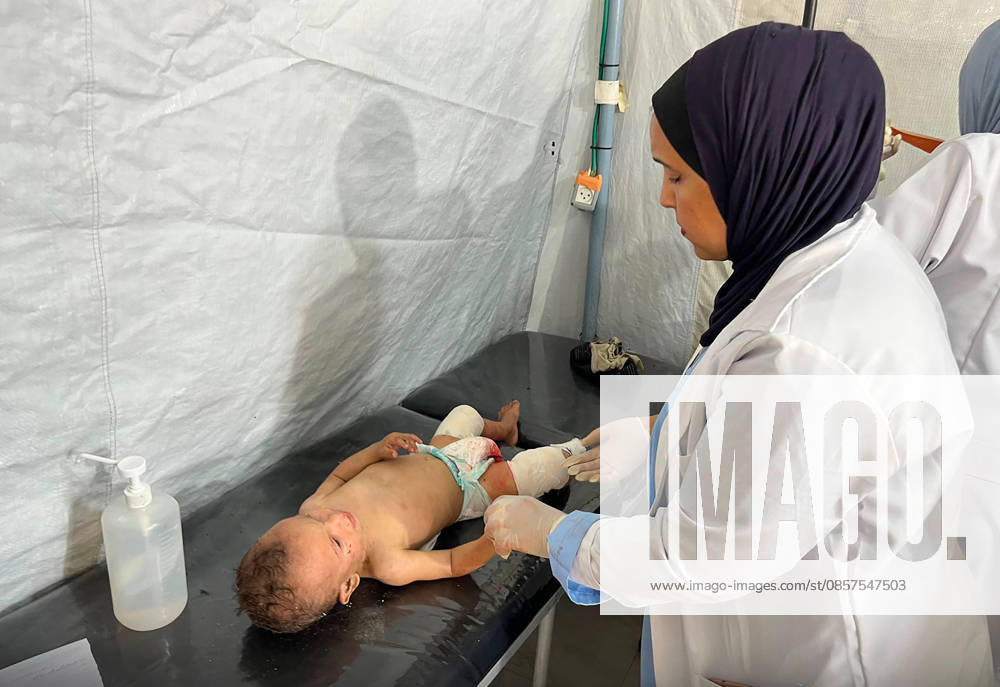 Injured children receive medical care at the Kuwaiti field hospital for treatment after an Israeli airstrike on tents sheltering displaced families in the Mawasi area, despite a cease-fire agreement in Khan Younis, Gaza Strip, Palestine, Monday, May 25, 2026. The strike killed a six-year-old boy and a woman, and wounded 20 others, mostly children and women, Medical sources said. GAZ2026052504 Kuwaitixfieldxhospital