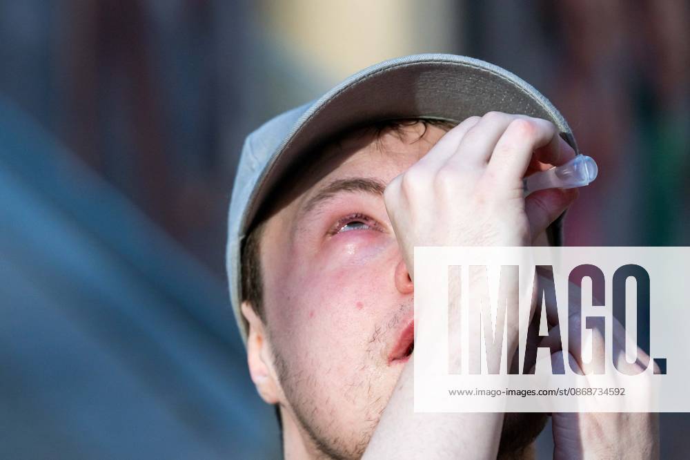 A youth treats his eyes with sterile water after being hit with teargas as students gather outside several schools in Liege during a protest against education reforms and budget cuts, on Tuesday 6 October 2026. Yesterday police arrested 16 people after the protests turned violent. The protests in French-speaking Belgium have been ongoing for months, following a series of reforms and budget cuts introduced by the French Community Government. JONASxROOSENS 188939287