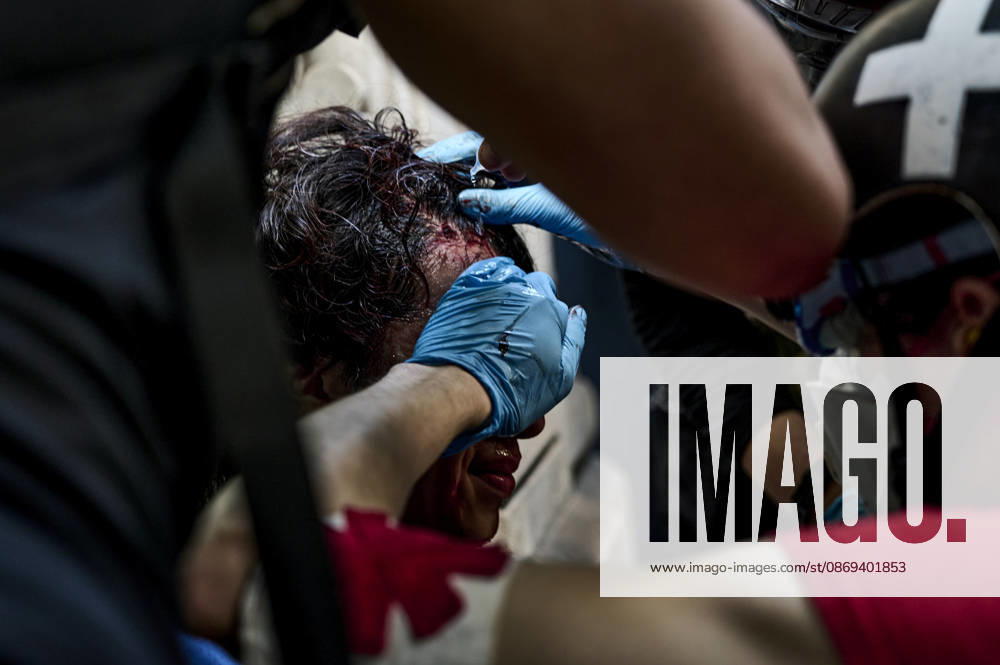 An injured protester during the high school students protest in Paris on October 13, 2026. - 13 10 2026 - France Ile-de-France (region) Paris - AntoninxBuratx Pictorium LePictorium_0343195