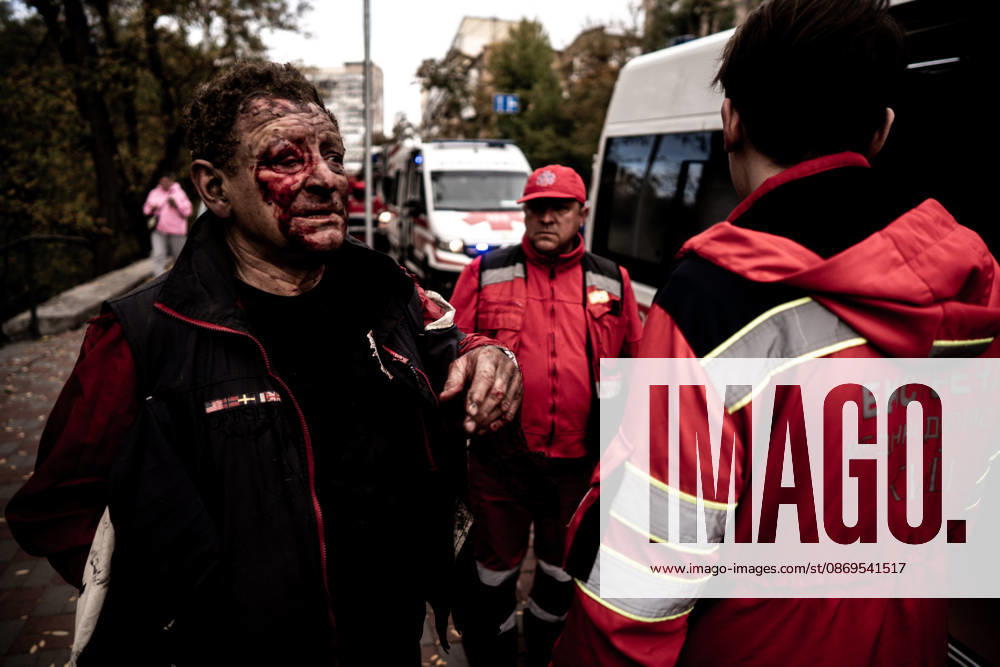 Aftermath of Russian drone attack in Kyiv KYIV, UKRAINE - OCTOBER 15: (EDITOR S NOTE: Image depicts graphic content) A Russian drone strikes a residential area in the city center, injuring a man who was near the impact site, in Kyiv, Ukraine, on October 15, 2026. Vincenzo Circosta Anadolu Kyiv Ukraine. Editorial use only. Please get in touch for any other usage.