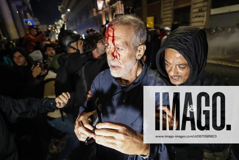 Demonstration against the Italian government in Rome ROME, ITALY, OCTOBER 24: (EDITOR S NOTE: Image depicts graphic content) A protester is seen after been wounded during clashes between Italian police and demonstrators against the Italian government in Rome, Italy, on October 24, 2026. Riccardo De Luca Anadolu Rome Italy. Editorial use only. Please get in touch for any other usage.