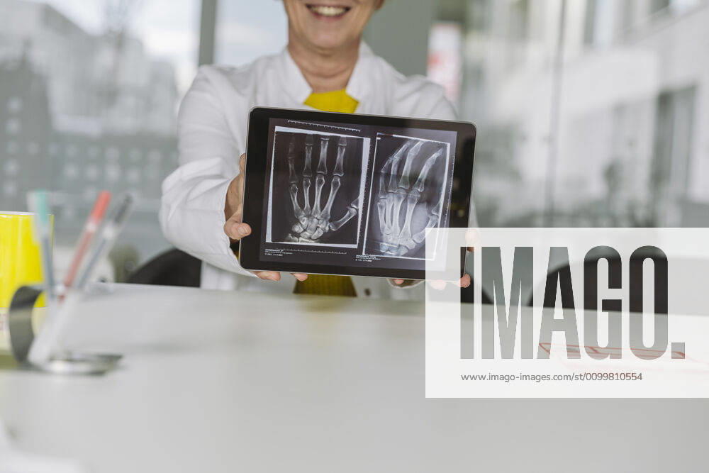 Doctor sitting at desk showing x-ray image of hand on digital tablet model released Symbolfoto property released MFF05500