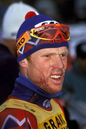 Björn Daehlie (Norwegen) ist von einem Sturz gezeichnet Nordischer Skilauf Herren Weltcup 1995 1996, Welt-Cup, Worldcup, World, WC, Ski Nordisch, Skisport, Skilanglauf Porträt Valtellina