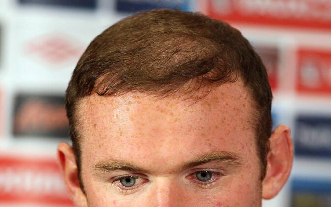 England s Wayne Rooney s hairline during his press conference..England Training - London Colney- 11 10 12 - Picture David Klein Sportimage EDITORIAL USE ONLY. No use with unauthorised audio, video, data, fixture lists, club league logos or live services. Online in-match use limited to 120 images, no video emulation. No use in betting, games or single club league player publications.