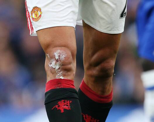 Manchester United ManU s Marouane FellainiÕs cut after getting fouled by ChelseaÕs David LuizÕs tackle during the Premier League match at the Stamford Bridge Stadium, London. Picture date October 23rd, 2016 Pic David Klein Sportimage EDITORIAL USE ONLY. No use with unauthorised audio, video, data, fixture lists, club league logos or live services. Online in-match use limited to 120 images, no video emulation. No use in betting, games or single club league player publications.