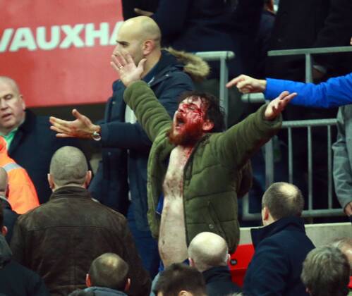 England v Scotland - FIFA World Cup WM Weltmeisterschaft Fussball 2018 Qualifier . . London, UK . . 11.11.2016 Fighting broke out amongst some England supporters, leaving one man covered in blood. 