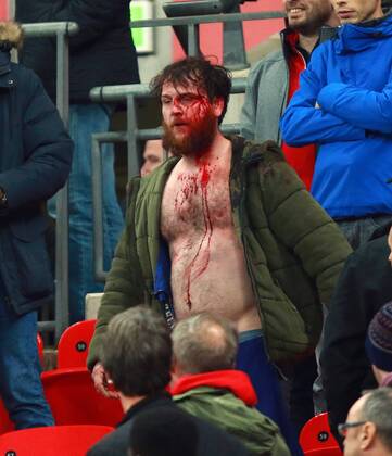 England v Scotland - FIFA World Cup WM Weltmeisterschaft Fussball 2018 Qualifier . . London, UK . . 11.11.2016 Fighting broke out amongst some England supporters, leaving one man covered in blood. 