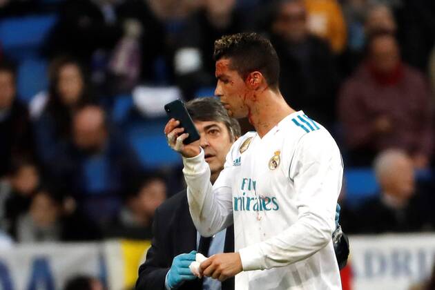 Themen der Woche - SPORT Bilder des Tages - SPORT Real Madrid s Portuguese striker Cristiano Ronaldo uses a cellphone to check a wound in his face during a Spanish league La Liga soccer match between Real Madrid and Deportivo at Santiago Bernabeu stadium in Madrid, Spain, 21 January 2018. Real Madrid vs Deportivo !ACHTUNG: NUR REDAKTIONELLE NUTZUNG!  Copyright: xJuanxCarlosxHidalgox GRAF4158 20180121-636521578355751076