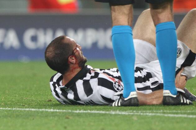 Fußball, Champions League, Giorgio Chiellini von Juventus Turin spielt nach Verletzung mit Kopfverband weiter