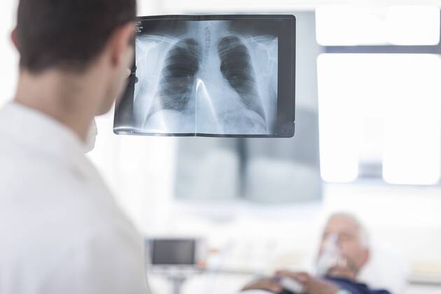 Doctor looking at x-ray image in a hospital room model released Symbolfoto property released  ZEF006249