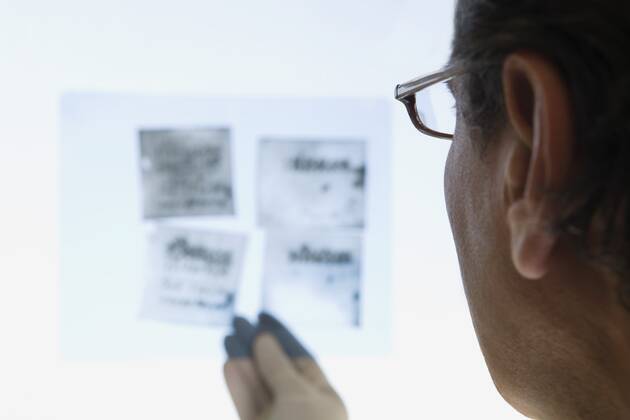 Scientist looking at Xray, close up, back view,model released, Symbolfoto,property released 03C01310