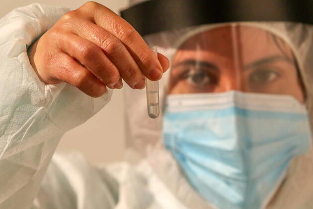 February 2, 2021: 2 February 2021 (Malaga) Today has begun the rapid testing of workers in the tourist, commercial and cultural sector of Malaga capital,in the Palacio de ferias y Congresos de Malaga, with the aim of influencing the safety of these businesses and achieving greater peace of mind for customers in the face of possible contagion. Given the persistence of the health crisis caused by the COVID-19, and the very negative impact it is having on tourism, commercial and cultural companies, they have considered it necessary to enhance the image of Malaga as a safe destination . In this regard, the representatives of both entities have agreed to highlight the opportunity to work together to unite efforts for the recovery of the activ - ZUMAc161 20210202_zap_c161_046 Copyright: xLorenzoxCarnerox