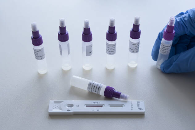 DEUTSCHLAND, Hamburg, Corona Pandemie, Pflegeheim fuer alte Menschen, Schnelltest PoC-Antigen fuer Besucher und Angehörige durch Bundeswehr Soldaten, Testkit der chinesischen Firma Beijing Hotgen Biotech Co. Hamburg Germany