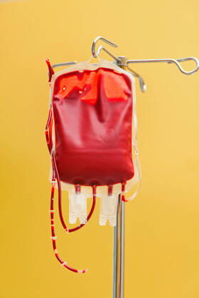 A unit of blood for infusion into a clinic Donor blood is administered McPBBO McPBBO