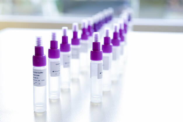DEUTSCHLAND, Hamburg, Corona Pandemie, Pflegeheim fuer alte Menschen, Schnelltest PoC-Antigen fuer Besucher und Angehörige, Testkit der chinesischen Firma Beijing Hotgen Biotech Co. Hamburg Germany