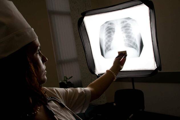  Doctor with chest X-ray model released, Symbolfoto, 06.02.2020 12:46:13, Copyright: xNomadSoulx Panthermedia28092945
