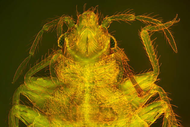 Bedbug, Common bedbug, Wall louse Cimex lectularius , piercing sucking mouth parts, dark field and phase contrast MRI image BLWS646764 Copyright: xblickwinkel F.xFoxx