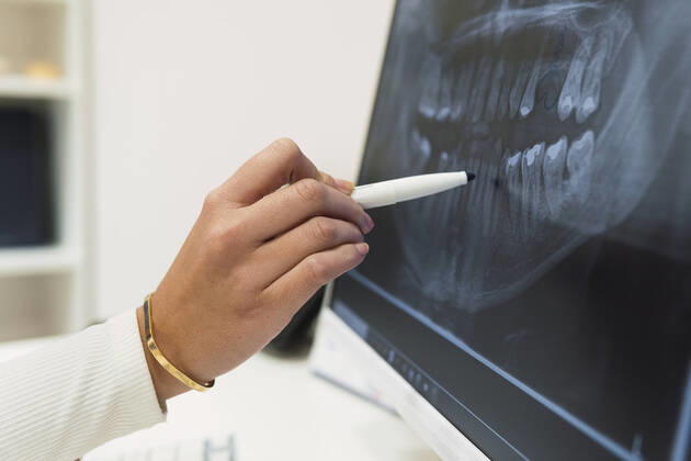 Dentist analyzing teeth X-ray over intraoral scanner screen in clinic model released property released, PNAF03083