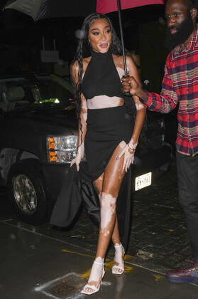 Winnie Harlow and Nina Agdal attends Vince Camuto Spring 2022 Invincible Pop up Event Foto:xJ.xNacionxx xFuturexImage