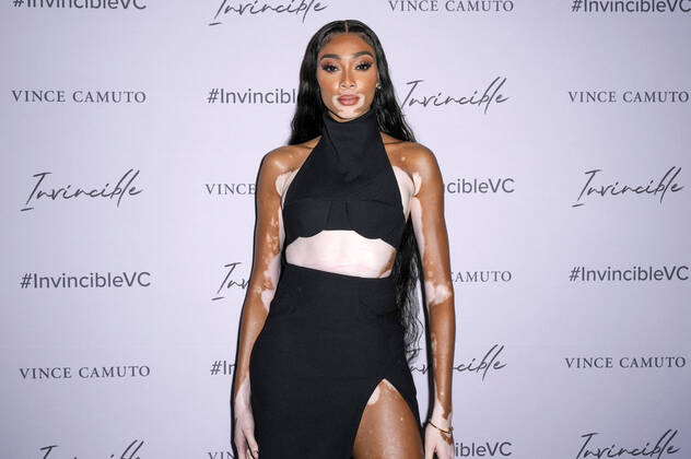 Winnie Harlow at the Vince Camuto Spring 2022 Invincible Pop up Event New York, 07 04 2022 Foto:xJ.xNacionxx xFuturexImage