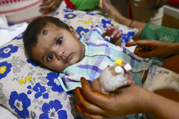Bangladesh Confronts Surge In Dengue Cases - Dhaka Children suffer from dengue fever receive medical treatment at a hospital, in Dhaka, Bangladesh, July 14, 2023. . Dengue infection has increased five times since 1 January to 31 May this year in Bangladesh. Children aged less than 15 years suffer from dengue fever the most. Dengue infection rates are usually high during monsoon and in the slum areas. Four variations of this virus have been identified. If infected with more than one variation or for the second time, severity of the infection is way more intense. Since many children are being diagnosed with dengue for the second or third time now, the situation is getting complicated. Meanwhile, many children with dengue infection are being a  Copyright: xSuvraxKantixDas ABACAx 860725_019 SuvraxKantixDas ABACAx 860725_019