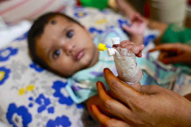 Bangladesh Confronts Surge In Dengue Cases - Dhaka Children suffer from dengue fever receive medical treatment at a hospital, in Dhaka, Bangladesh, July 14, 2023. . Dengue infection has increased five times since 1 January to 31 May this year in Bangladesh. Children aged less than 15 years suffer from dengue fever the most. Dengue infection rates are usually high during monsoon and in the slum areas. Four variations of this virus have been identified. If infected with more than one variation or for the second time, severity of the infection is way more intense. Since many children are being diagnosed with dengue for the second or third time now, the situation is getting complicated. Meanwhile, many children with dengue infection are being a  Copyright: xSuvraxKantixDas ABACAx 860725_020 SuvraxKantixDas ABACAx 860725_020