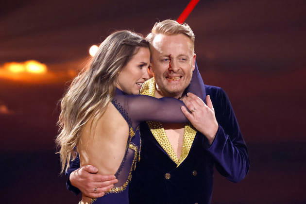 Entertainer Ross Antony and professional dancer Mariia Maksina at the sixth dance show of the 19th season of the RTL dance show Lets Dance at the Coloneum Ross Antonys face is covered in blood after he suffers a bleeding wound while dancing Cologne, 17 04 2026 NRW Germany Copyright: xChristophxHardtx