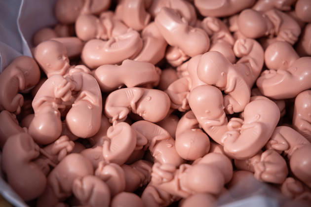 On Saturday, September 19, 2026, numerous anti-abortion activists participated in a March for Life organized by the Federal Association for the Right to Life in Berlin. Plastic embryo models. The Federal Association for the Right to Life is demonstrating against abortion and assisted suicide. Accordi Copyright: epd-bild HansxScherhaufer epd-Marsch_fuers_Leben9-kopieren