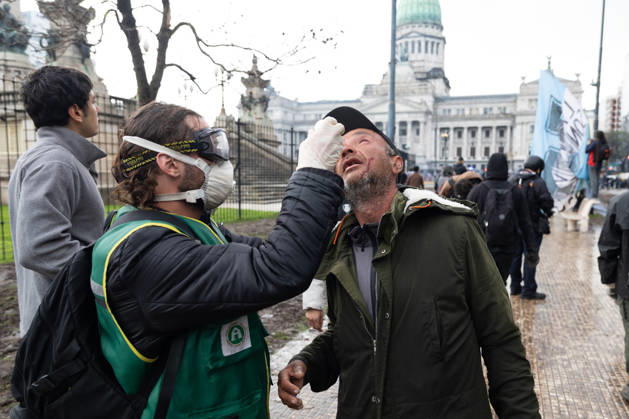 October 16, 2026, Buenos Aires, Buenos Aires, Argentina: Medical staff treat an injured man affected by tear gas during clashes with police. Buenos Aires Argentina - ZUMAp265 20261016_zip_p265_051 Copyright: xDelfinaxCorberaxPix