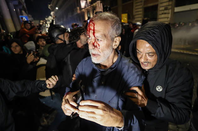 Demonstration against the Italian government in Rome ROME, ITALY, OCTOBER 24: (EDITOR S NOTE: Image depicts graphic content) A protester is seen after been wounded during clashes between Italian police and demonstrators against the Italian government in Rome, Italy, on October 24, 2026. Riccardo De Luca Anadolu Rome Italy. Editorial use only. Please get in touch for any other usage.  Copyright: x2026xAnadoluxRiccardoxDexLucax
