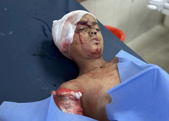 Nahostkonflikt, Gaza, Tote und Verletzte nach israelischen Angriffen auf Khan Yunis