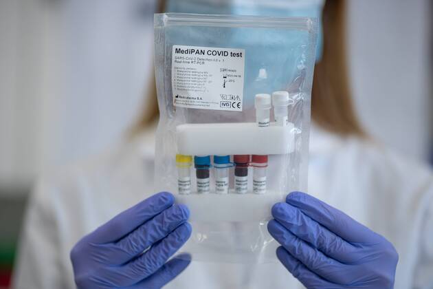 Coronavirus in Polen, Erster Antikörpertest der Akademie der Wissenschaft in Poznan